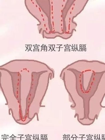 广州第三代试管哪个医院好？试管三代广州哪家医院强？