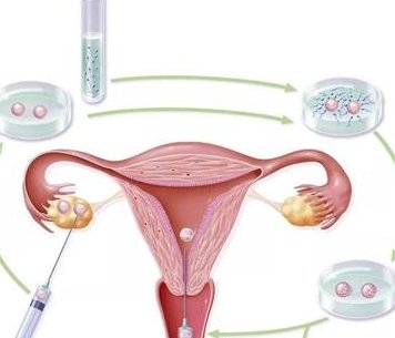 国内哪里的医院做试管可以生孩子(试管婴儿生孩子要多少钱)